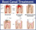 sasi dental clinic nagercoil